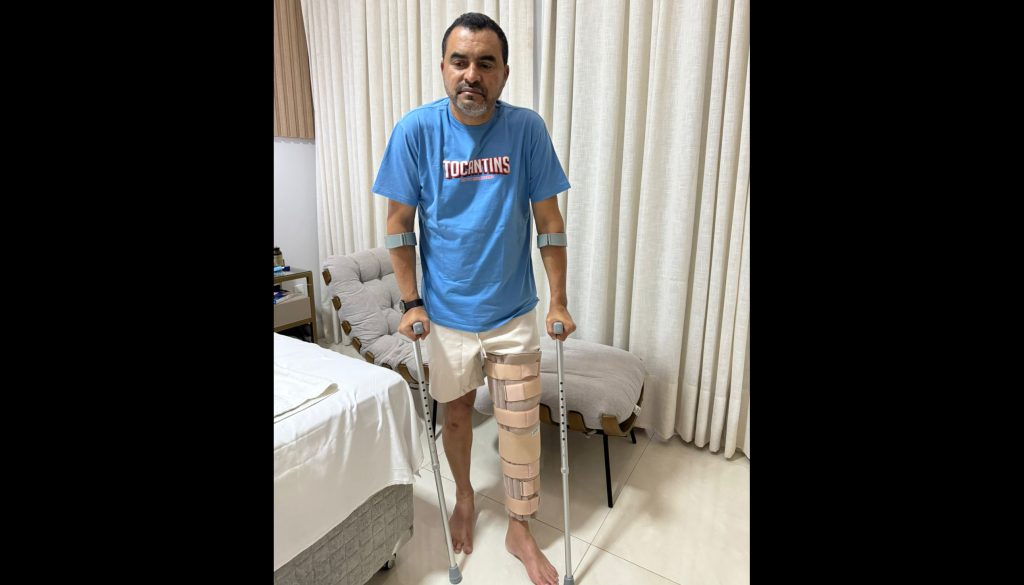Governador Wanderlei Barbosa rompe ligamentos do joelho e passará por cirurgia.
