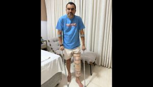 Governador Wanderlei Barbosa rompe ligamentos do joelho e passará por cirurgia.